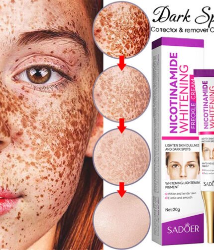 Nicotinamide Whitening Freckles Cream Remove Melasma Dark Spot Acne Marks Lightening Melanin Brightens Skin Tone Face Skin Care