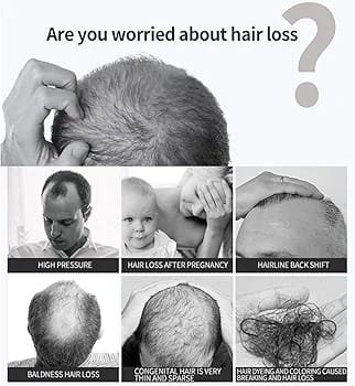 WhatsApp-Image-2024-10-15-at-5.48.40-PM.jpeg