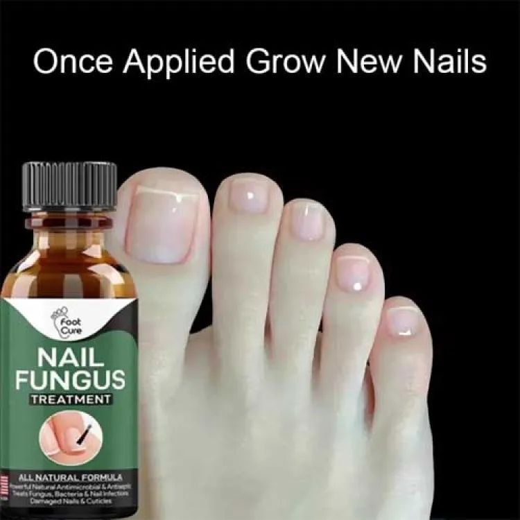 nail-fungus-treatment-stop-fungal-growth-effective-fingernail-10ml-27098-646.jpg